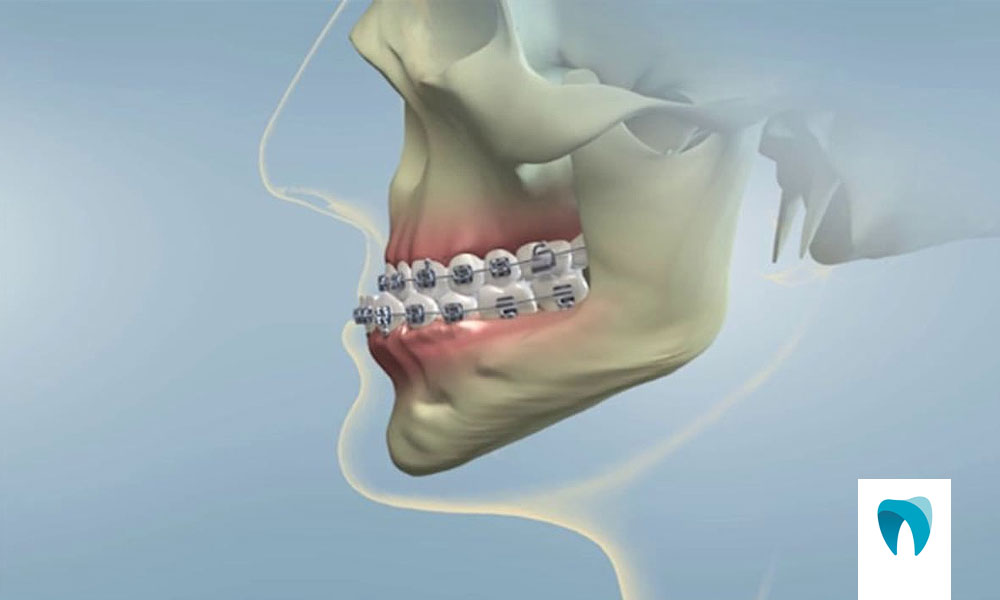 Cirurgião buco-maxilo-facial: entenda essa especialidade odontológica